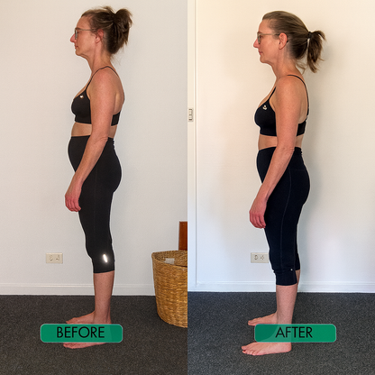 SpineEase™ Back Brace – Straighter Posture & Real Pain Relief in Weeks