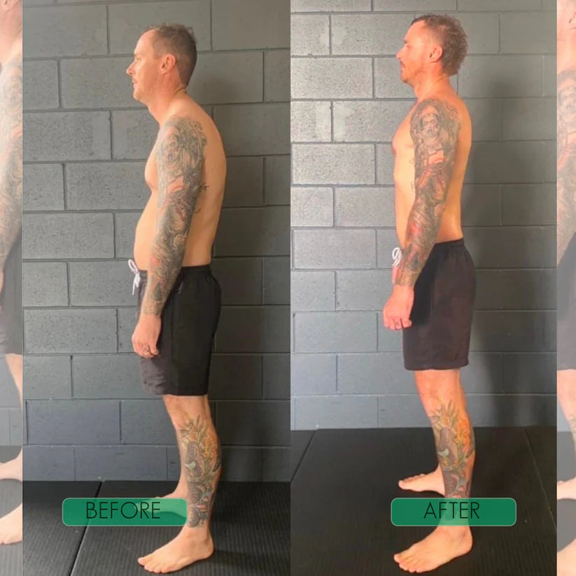 SpineEase™ Back Brace – Straighter Posture & Real Pain Relief in Weeks